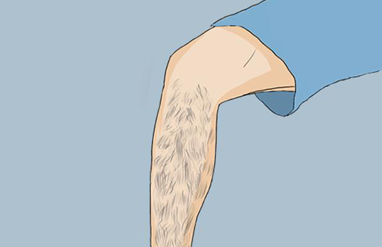 盤點那些錯誤的脫毛方法 ，你中招了沒