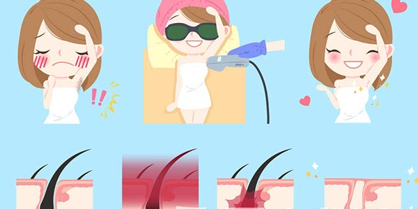 家用光子脫毛儀代工生產(chǎn)