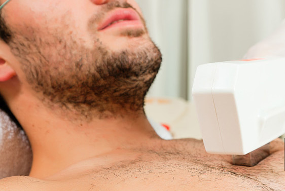 在家脫毛：不僅女性要脫毛，男性也逃不掉(圖1)