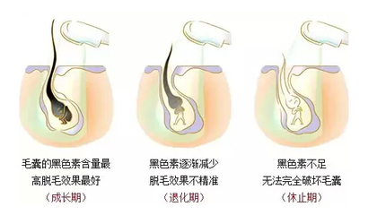 為什么小姐姐們都選擇在春季脫毛呢？(圖1)