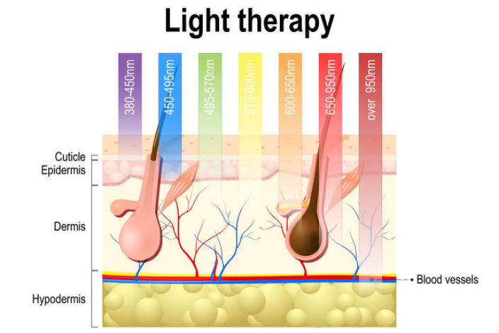 家用光子脫毛儀能夠永久脫毛是騙局還是真相?(圖2) 家用光子脫毛儀能夠永久脫毛是騙局還是真相?(圖2)