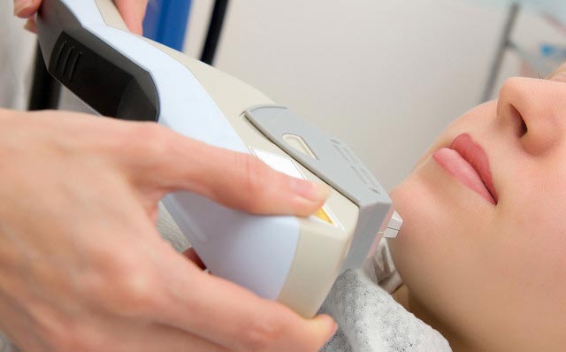 IPL脫毛儀批發(fā)