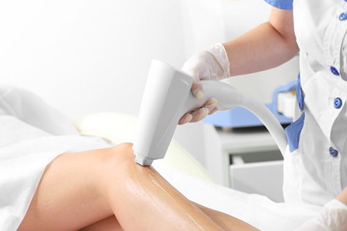 脫毛器的優勢所在(圖1)