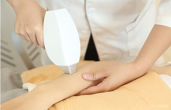 家用脫毛儀如何正確的選擇(圖1)