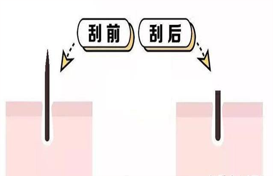 刮毛后毛發(fā)越變越硬是怎么回事(圖1)
