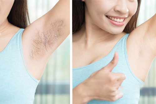 ipl光子脫毛儀怎么使用(圖1)