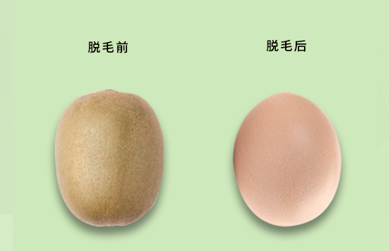 脫毛要趁早，你不脫毛都不知道自己到底有多白(圖1)