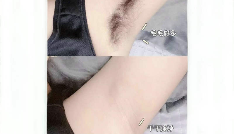 秋天脫毛有什么好處嗎？(圖1)