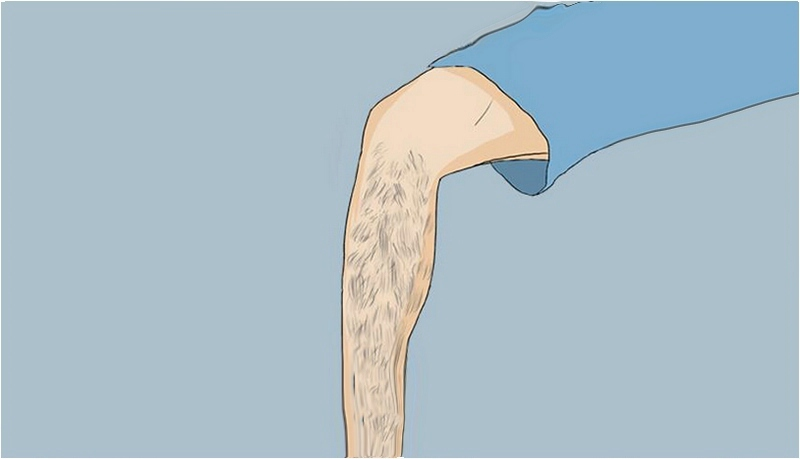 家用脫毛儀用之前可以拔毛嘛(圖1)